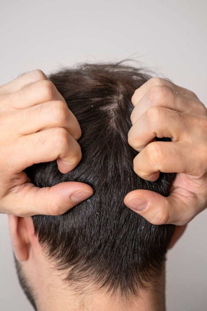 Especialistas en alopecia en Burela - Borja Gomez Vila